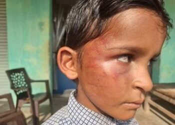 CG NEWS: गिनती में गलती करने पर टीचर ने 7 साल के बच्चे को पीटा, आंख में उतरा खून; परिजनों ने दर्ज कराई FIR