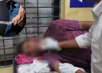 CG NEWS: दिनदहाड़े SDOP पर चाकू से हमला, दुर्ग से लगातार पीछा कर रहा था हमलावर