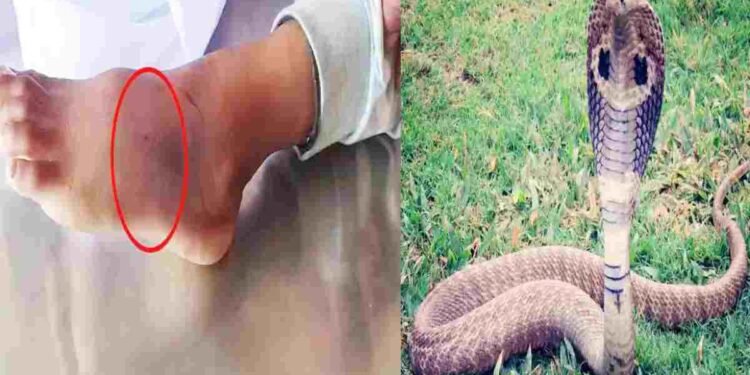 CG NEWS: सर्पदंश से पार्षद के 3 साल के बेटे की मौत, घर में खेलते समय डसा