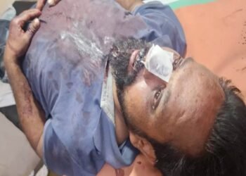 रायपुर में खौफनाक वारदात: हेडलाइट की रोशनी मारने से टोका, तो बस सुपरवाइजर को चाकुओं से गोदा, ₹15 हजार की लूट