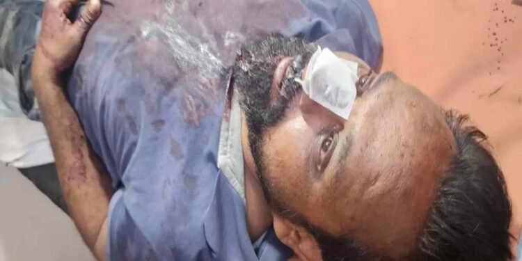 रायपुर में खौफनाक वारदात: हेडलाइट की रोशनी मारने से टोका, तो बस सुपरवाइजर को चाकुओं से गोदा, ₹15 हजार की लूट