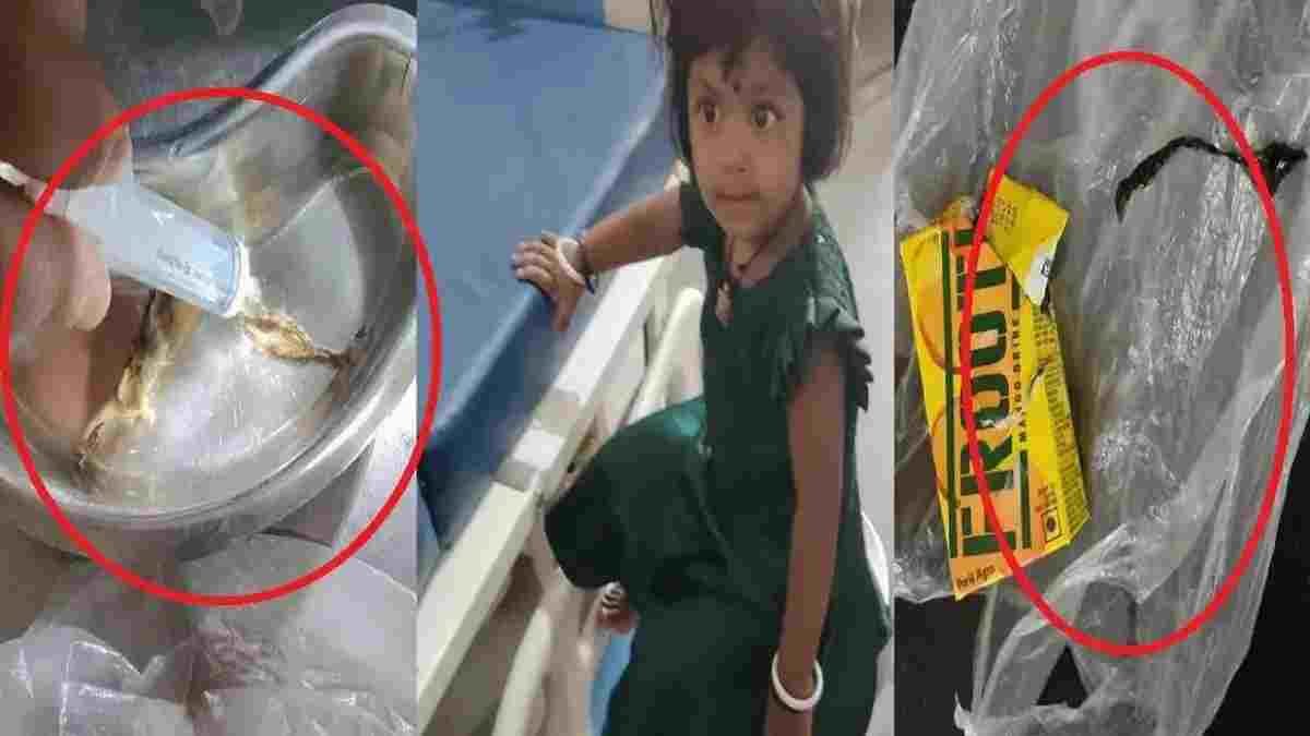 CG NEWS- फ्रूटी पाउच में छिपकली की चमड़ी मिलने का दावा, 2 वर्षीय बच्ची की तबीयत बिगड़ी