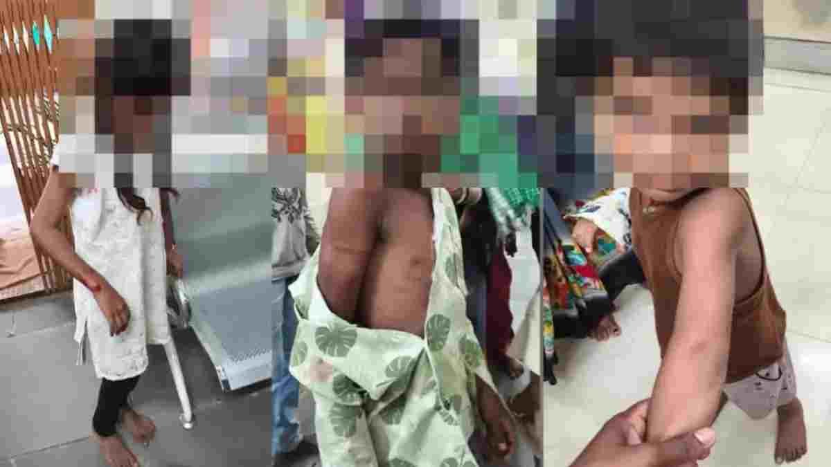 बलौदाबाजार में आवारा कुत्ते का आतंक: एक ही गांव के 8 बच्चों को बनाया शिकार, एक की हालत गंभीर; ग्रामीणों में दहशत