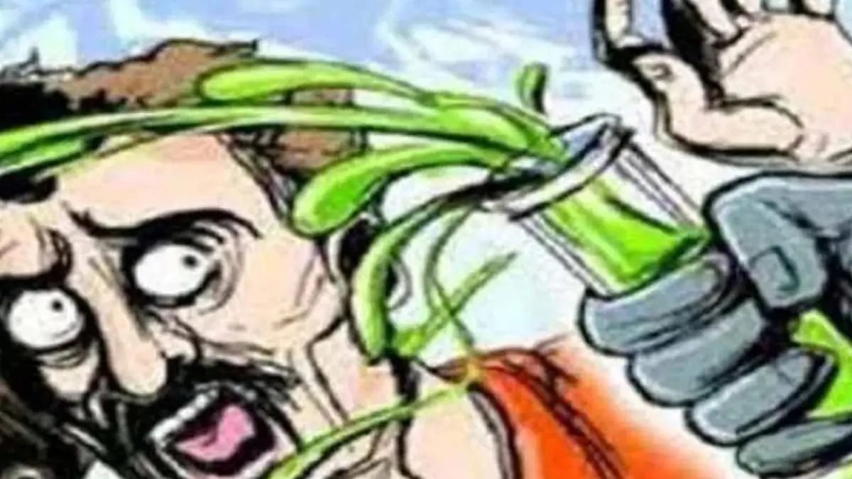 चांपा में प्रेमिका ने प्रेमी पर फेंका एसिड, चार साल पुराने प्रेम संबंध में विवाद के बाद हमला; युवक झुलसा
