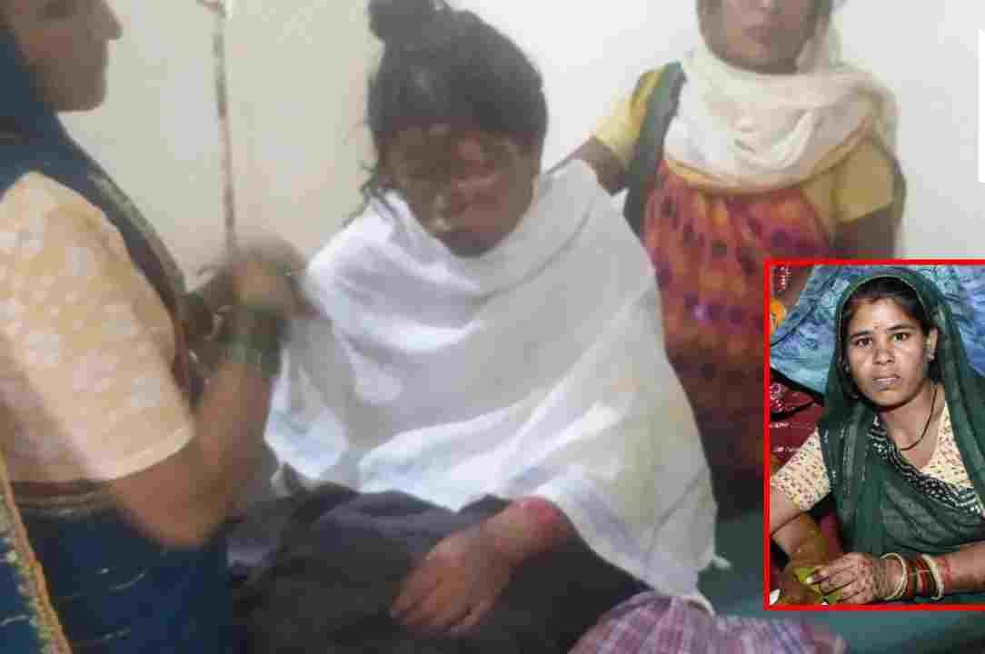 कवर्धा में मानवता शर्मसार: ससुर और सास ने बहू पर छिड़का पेट्रोल, जिंदा जलाने की कोशिश; गंभीर रूप से झुलसी महिला